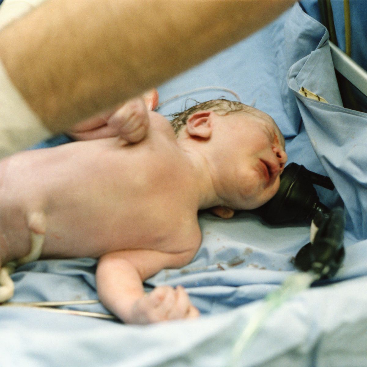 A newborn baby being cared for in hospital