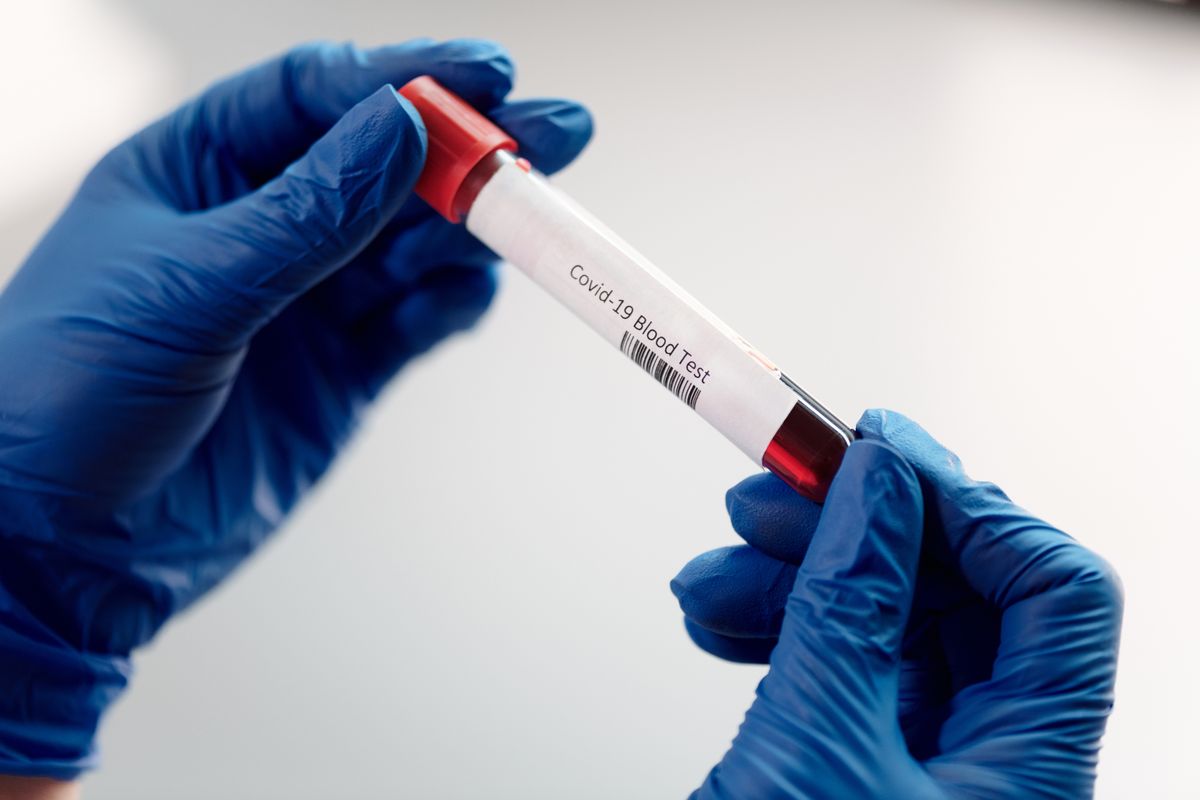 A blood sample tube held by gloved hands